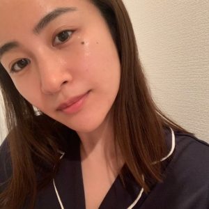 睡眠不足は毛穴が開く要因になる